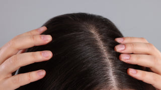 Harnessing the Natural Power of Saw Palmetto Extract for Hair Loss